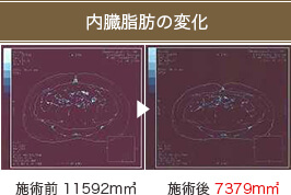 内臓脂肪の変化