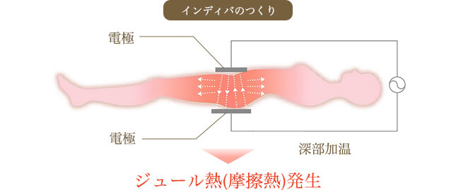 インディバのつくりについて